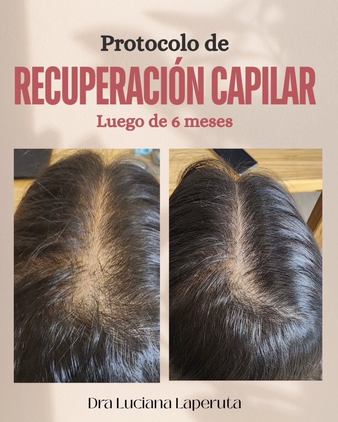 Evolución Capilar