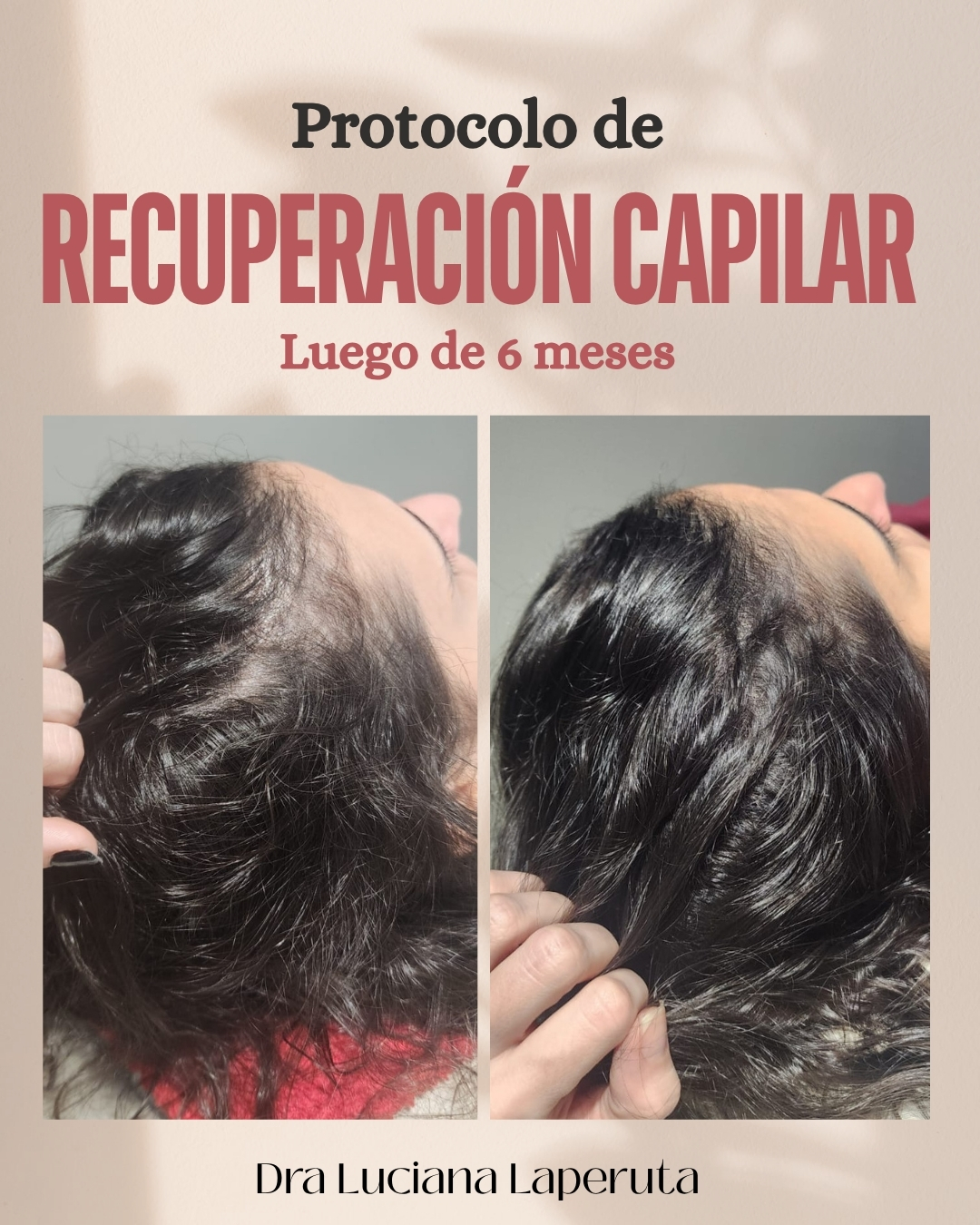 Resultados Consolidados